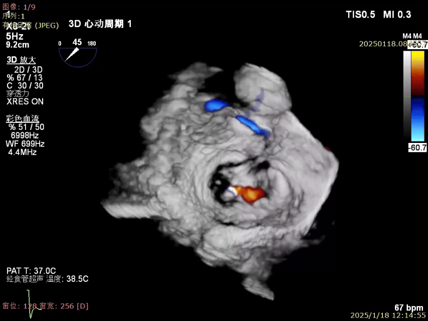 2.gif
