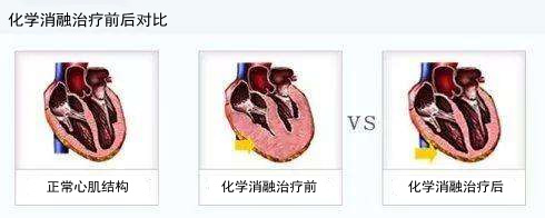 化.jpg