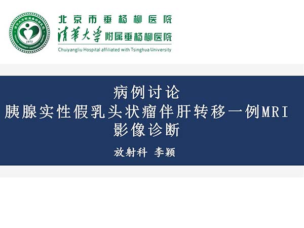 【杨柳病例】胰腺实性假乳头状瘤伴肝转移一例MRI影像诊断