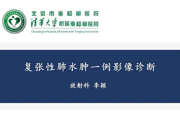 【杨柳病例】复张性肺水肿一例影像诊断